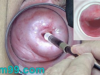 Japanese Endoscope Camera medial Cervix Cam earn Vagina
